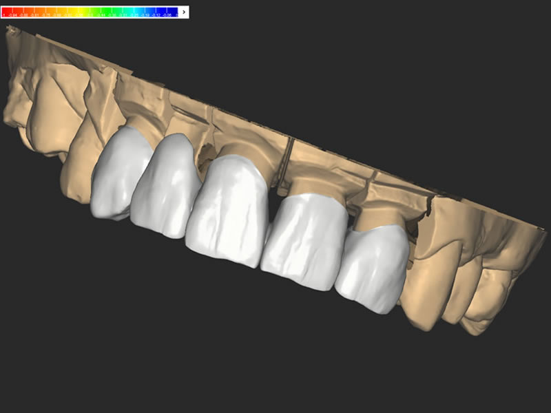 zirconio-1