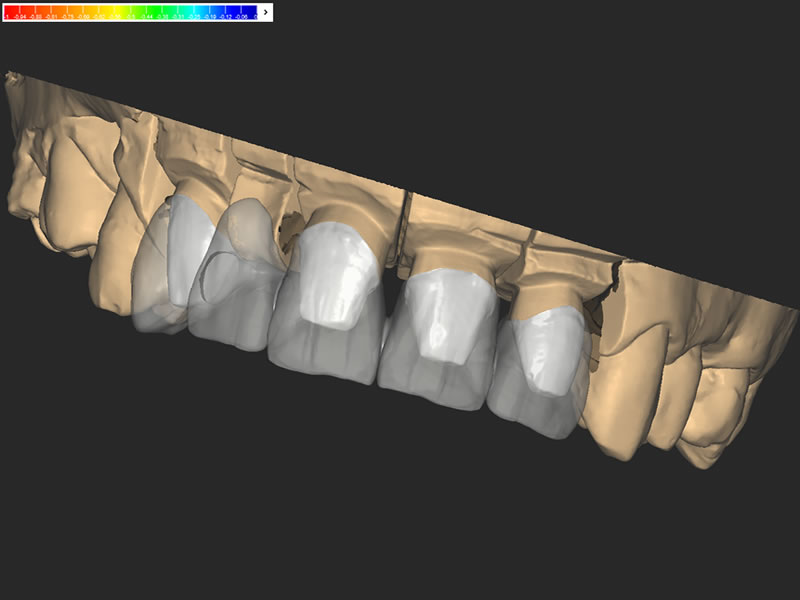 zirconio-2